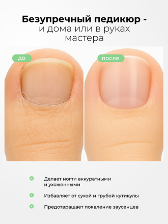 MANITA   Нано Лезвие ЩЕЛОЧНОЙ  100мл   Кератогель для педикюра   {7728}